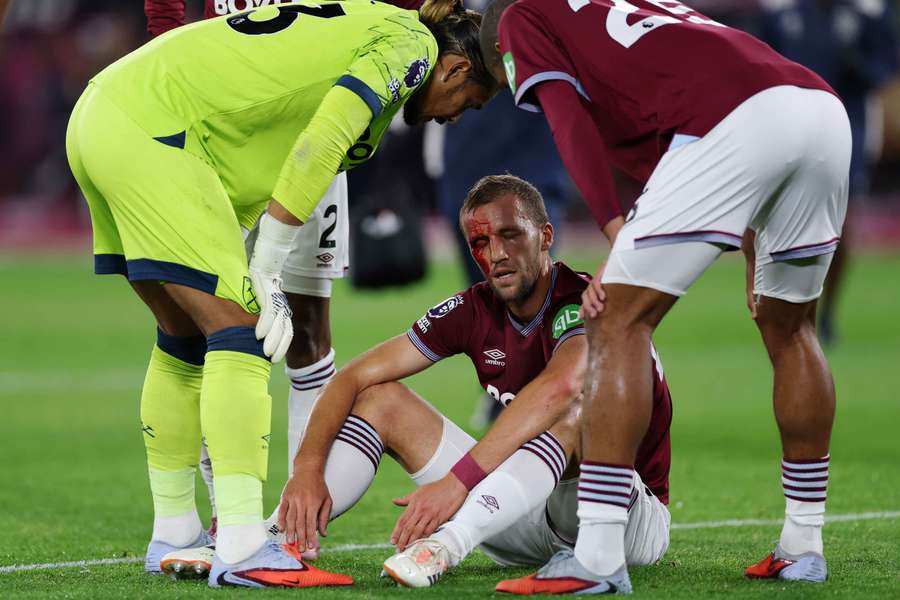 Český záložník West Hamu Tomáš Souček utrpěl krvavé zranění, v utkání ale pokračoval. Český záložník West Hamu Tomáš Souček utrpěl krvavé zranění, v utkání ale pokračoval.