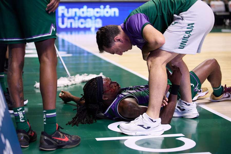 Kendrick Perry, con el rostro ensangrentado tras recibir el codazo de Musa
