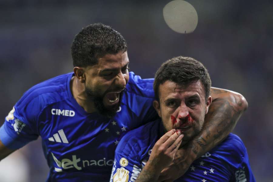 Matheus Henrique quebrou o nariz depois de levar uma pesada do zagueiro Eduardo Doma Matheus Henrique quebrou o nariz depois de levar uma pesada do zagueiro Eduardo Doma