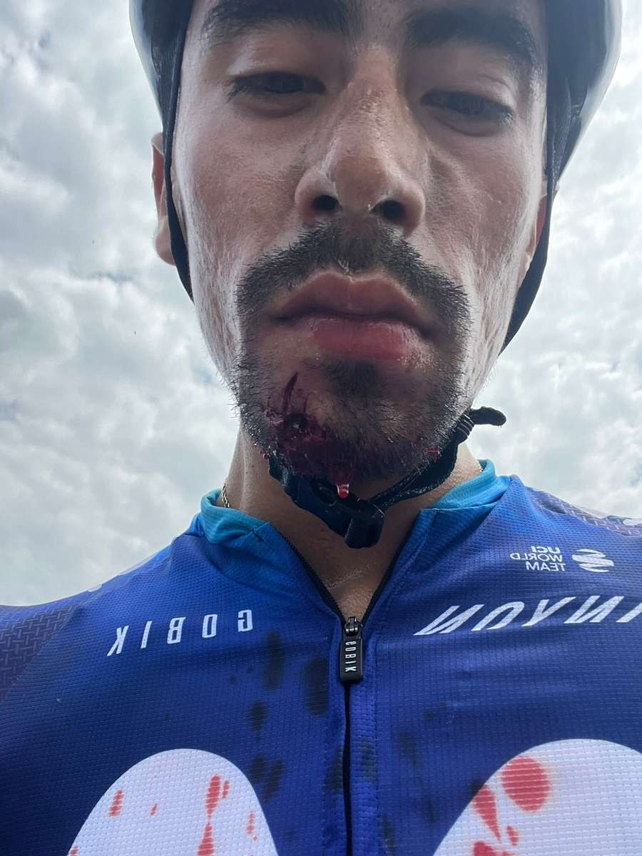 Pai do ciclista postou foto do filho após a agressão