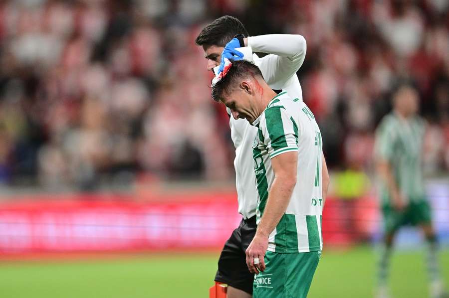 Krvavé zranění Václava Pilaře v derby se Slavií. Krvavé zranění Václava Pilaře v derby se Slavií.
