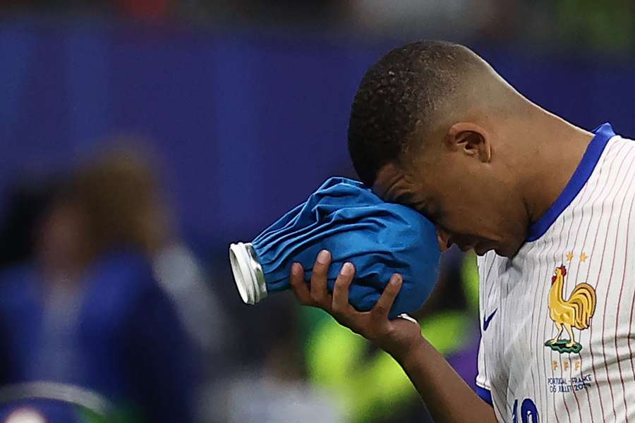 Mbappé está jugando con la nariz rota