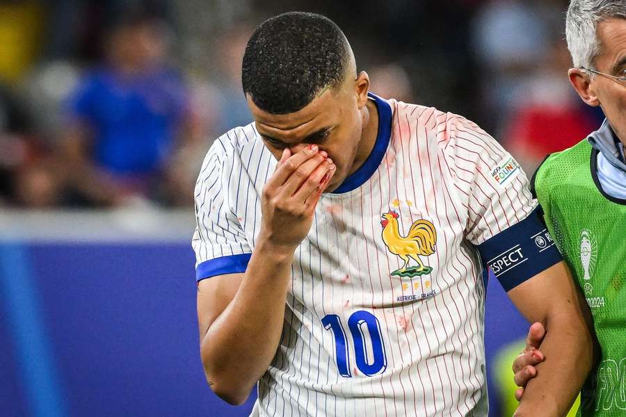 Mbappé se machucou gravemente contra a Áustria