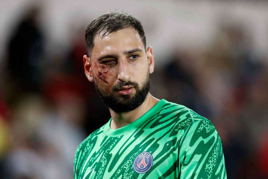 Donnarumma hat eine heftige Schramme erlitten