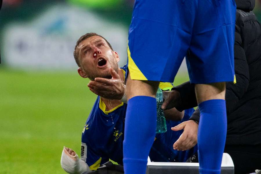 Lesões de Edin Dzeko