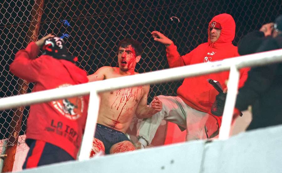 A Universidad de Chile fan during the interruption A Universidad de Chile fan during the interruption