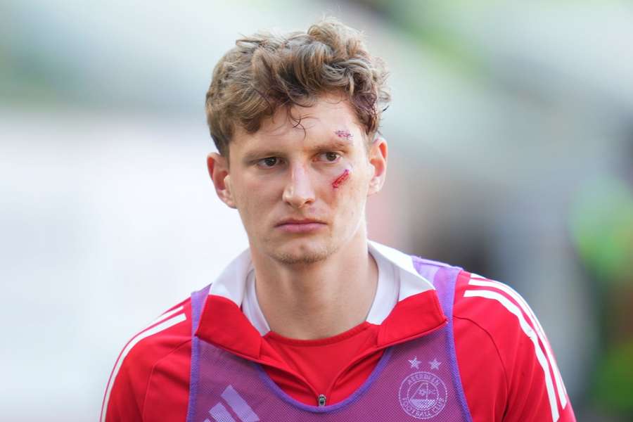 Jack MacKenzie vom FC Aberdeen trug durch das Wurfgeschoss eine Wunde im Gesicht davon.