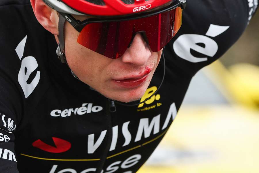 Jonas Vingegaard dopo l'incidente nella quinta tappa dell'ultima Parigi-Nizza