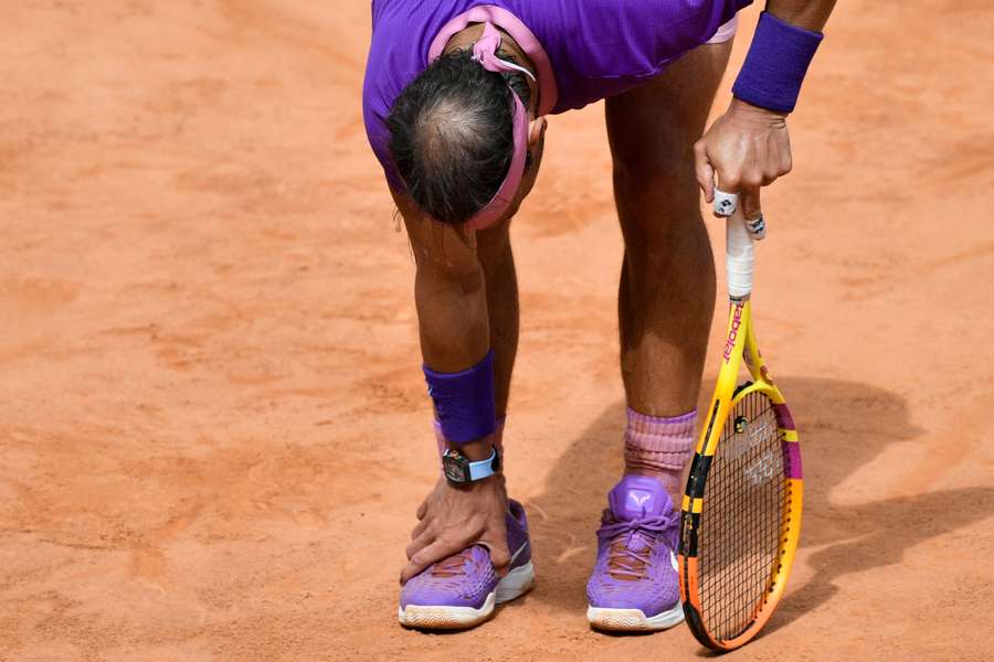 El síndrome de Müller-Weiss que lastró a Nadal, una patología rara