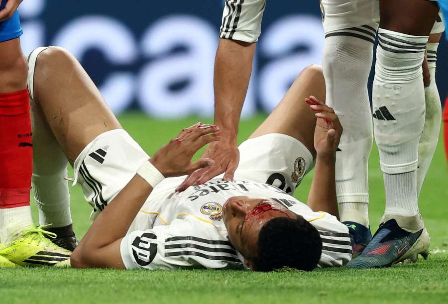 Kylian Mbappé ferito alla fronte durante il match col Girona