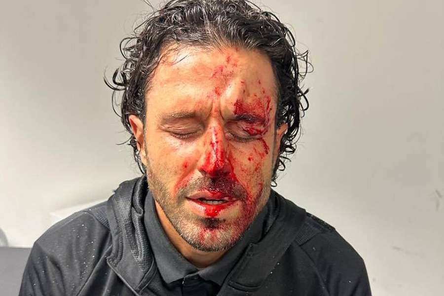 Fabio Grosso blev offer for brutale hændelser søndag.