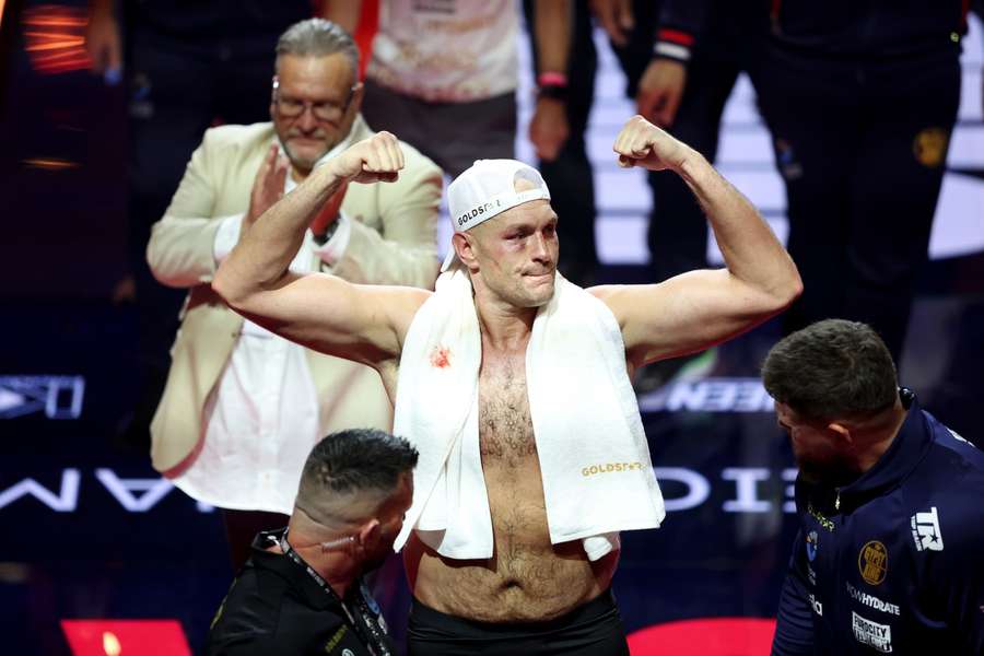 Tyson Fury.