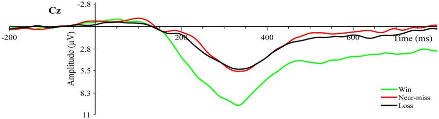 Diferença de atividade cerebral entre vitória, derrota e near-miss de jogador de cassino Diferença de atividade cerebral entre vitória, derrota e near-miss de jogador de cassino