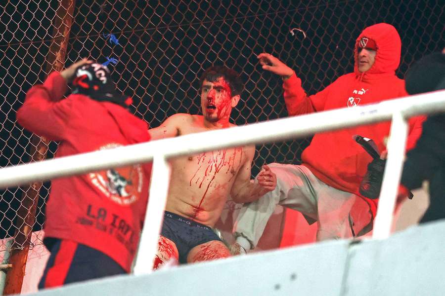 A Universidad de Chile fan bleeds during the match against Independiente