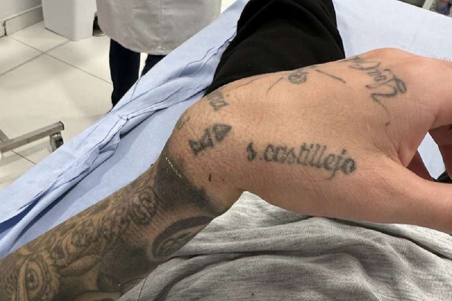 Samu Castillejo, operado de la fractura en su muñeca izquierda
