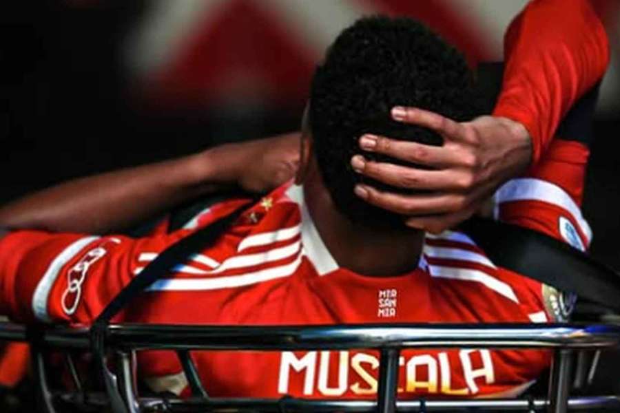 Musiala si ze zápasu s PSG odnesl zlomenou lýtkovou kost
