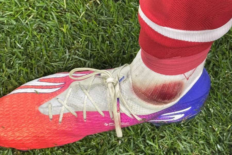 O pé direito de Pau Victor no final do SC Braga-Gil Vicente