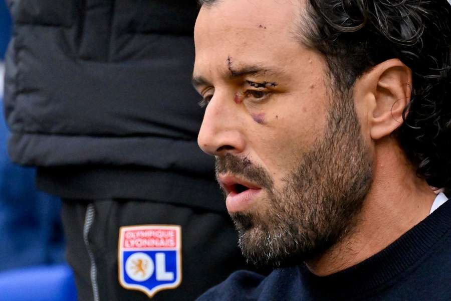 Nach Angriff auf Teambus: Lyon-Trainer Fabio Grosso hatte Schnittwunden im Gesicht erlitten.